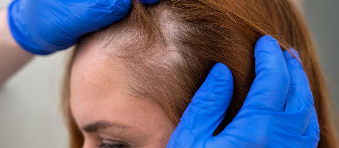 woman-getting-hair-loss-treatment-clinic